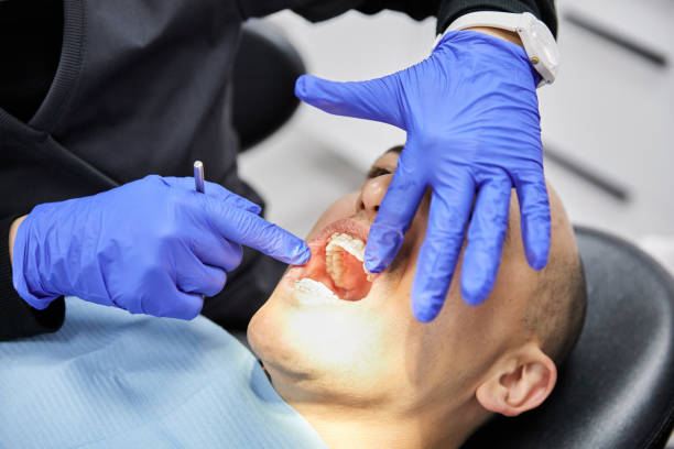 Best Emergency Wisdom Teeth Removal in Waldwick, NJ